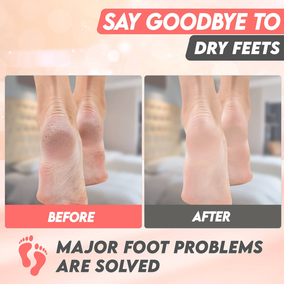 Karma Organic spa - Foot Peel Mask 2 Pack – Peach Peeling Foot Mask 100% Organic