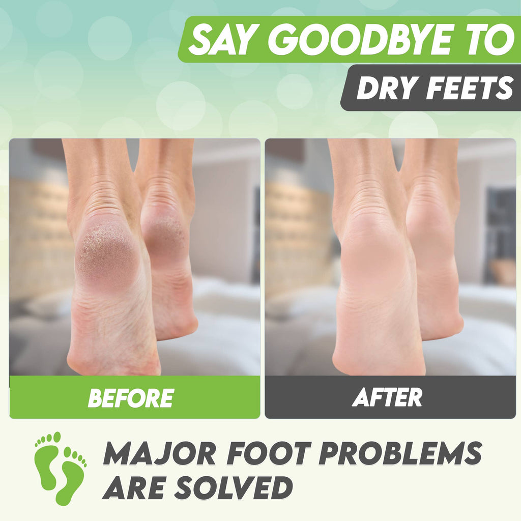 Foot Peel Mask 2 Pack –Green Tea Foot Mask Peel 100% Organic