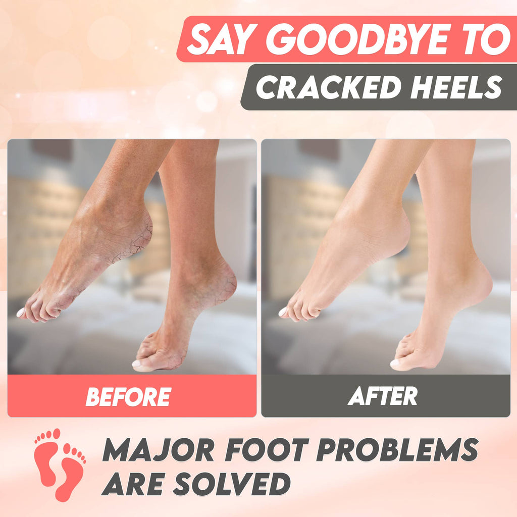 Karma Organic spa - Foot Peel Mask 2 Pack – Peach Peeling Foot Mask 100% Organic